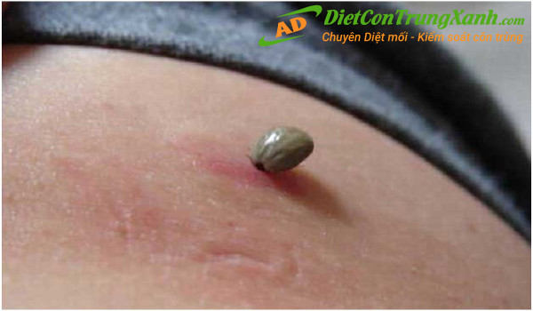 Bo-chet-can-tren-nguoi